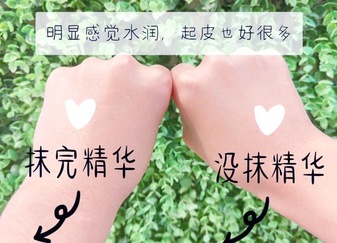 韩国祛痘护肤品，哪款最有效？-图2