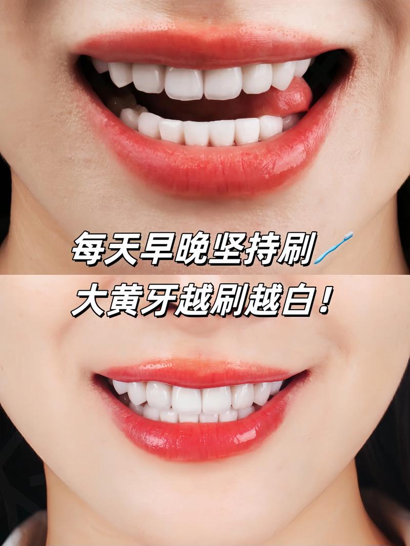 牙膏祛痘？靠谱吗？-图3