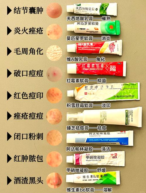 祛痘药膏越抹痘痘越红-图1